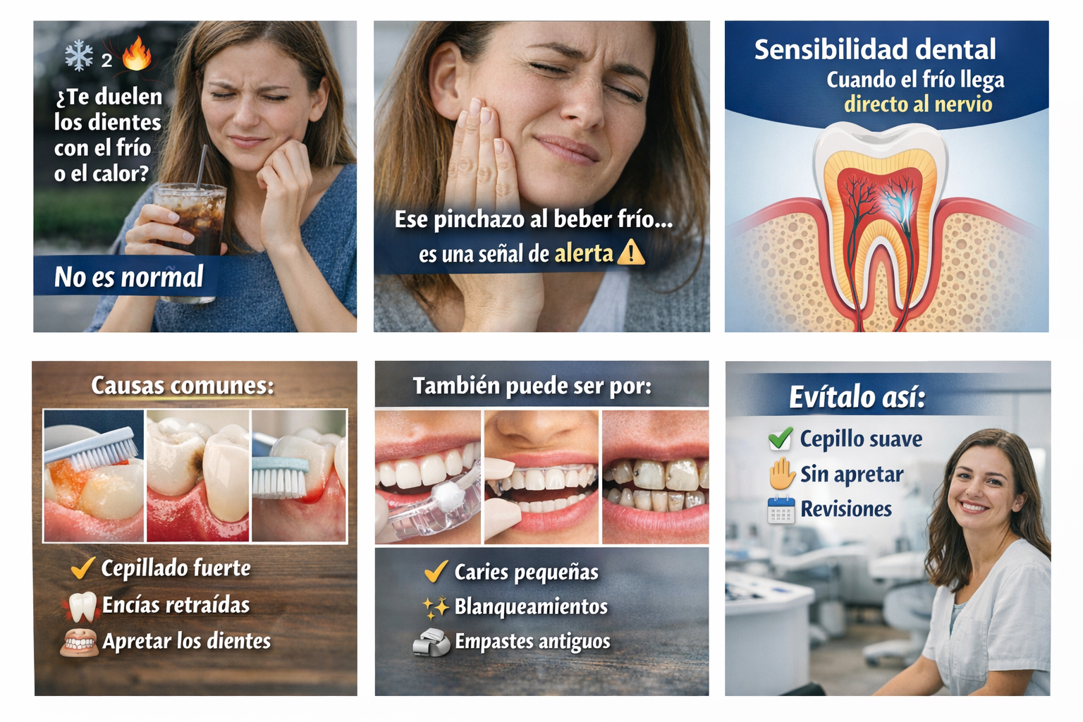 Sensibilidad Dental que es.png